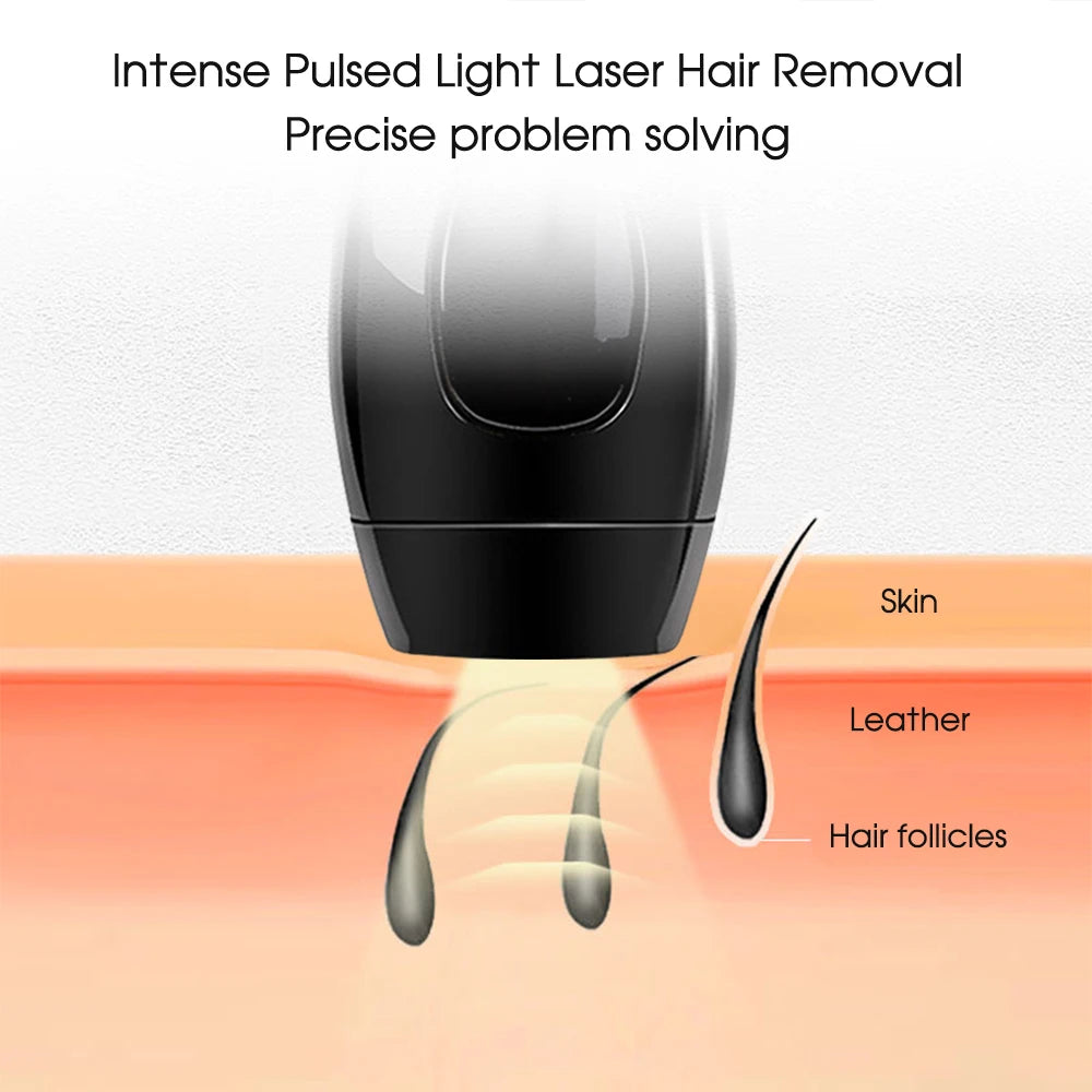 IPL Hair Removal Device