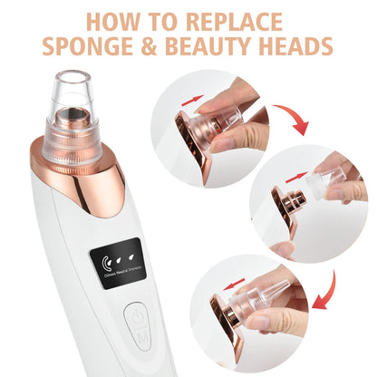 Blackhead Remover Vacuum 